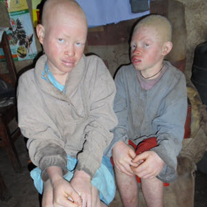 Albino-Rescue_Mary-Brian_Humanity-Healing