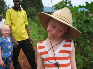 Nonprofit_working_with_albinos